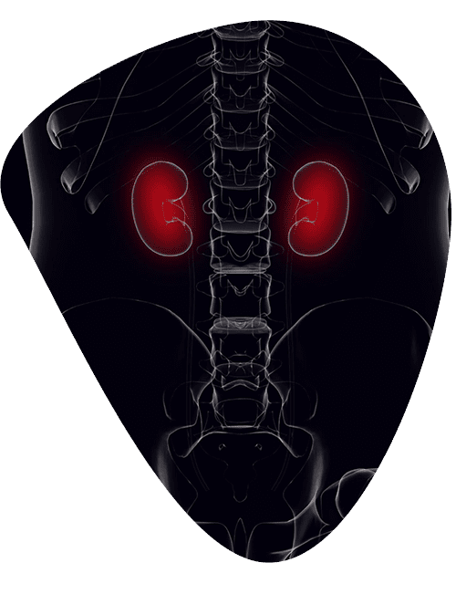 costo-de-cirugia-de-trasplante-renal.png