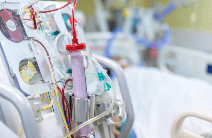 Colocación de catéter para hemodiálisis ofrecida por el Dr. Eduardo Cetina Pacheco: acceso seguro y eficaz para tu tratamiento renal